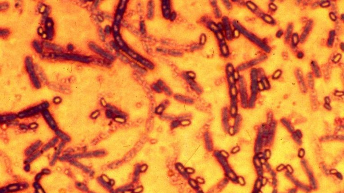 Esporas de la bacteria Bacilus antracis, que causa el ántrax, en una imagen de archivo.-AFP / MOSCÚ