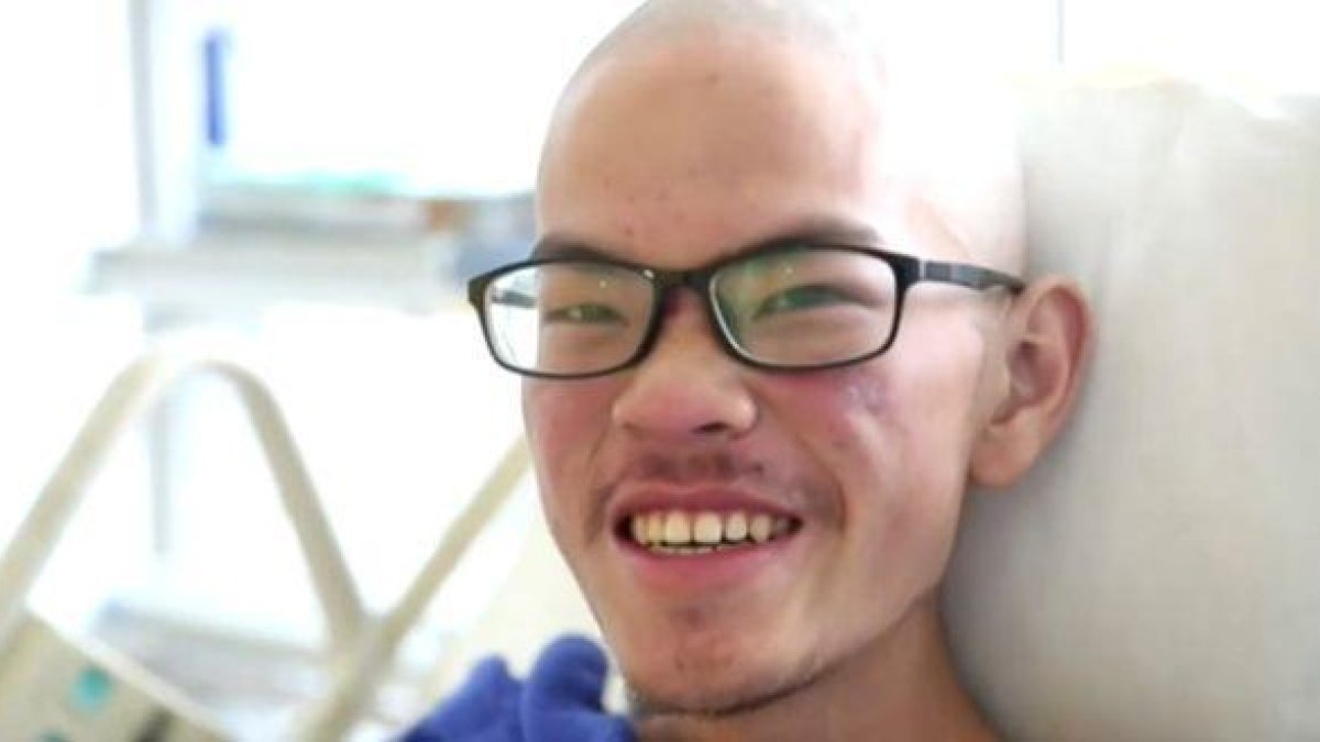 El montañero taiwanés Liang Sheng-yu en el hospital durante se recupera de sus heridas.-