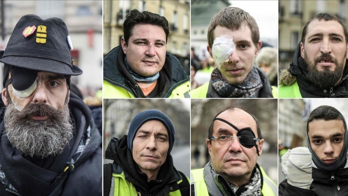 Algunos de los manifestantes chalecos amarillos que acusan a la policía francesa de sus heridas.-FRANCE PRESS