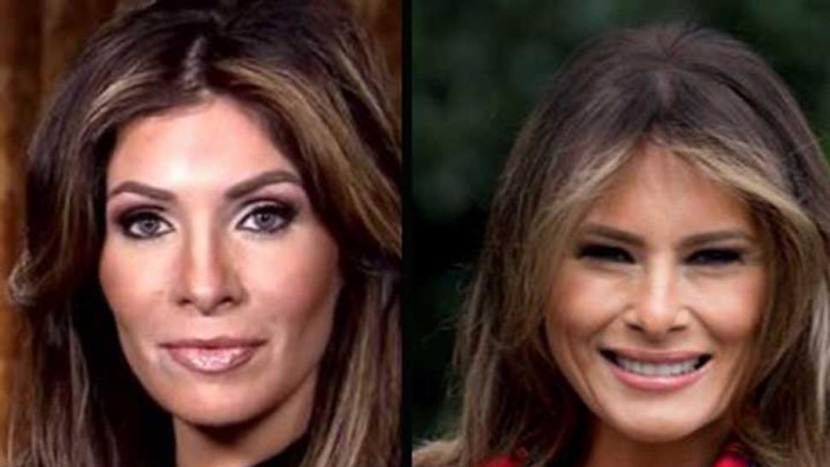La texana Claudia Sierra lleva gastados 50.000 dólares en operaciones para parecerse a Melania Trump.-PERIODICO (FACEBOOK / AP)