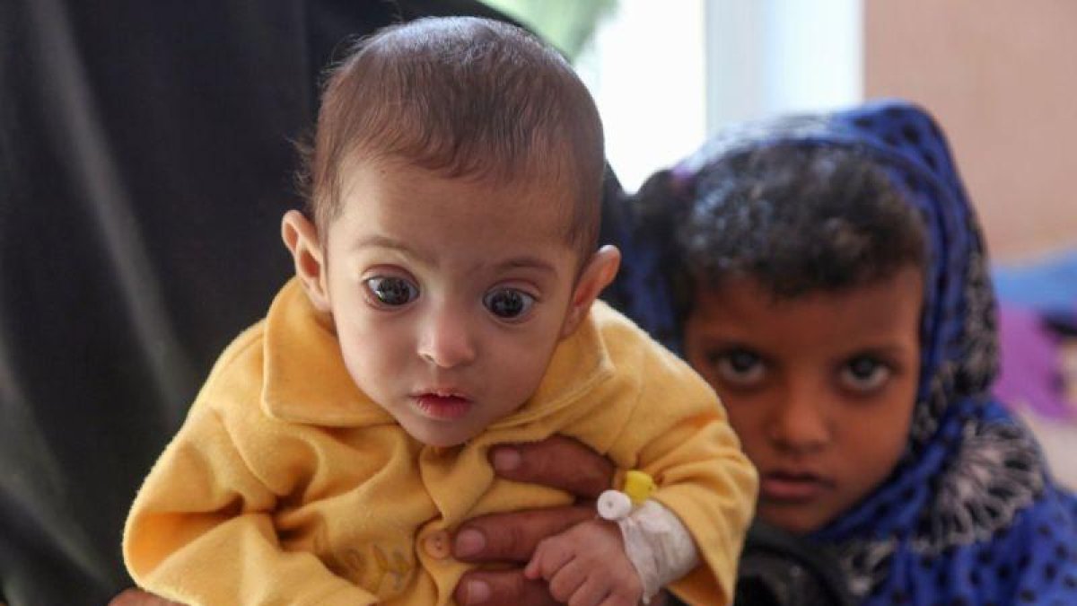 Un niño yemení.-AFP
