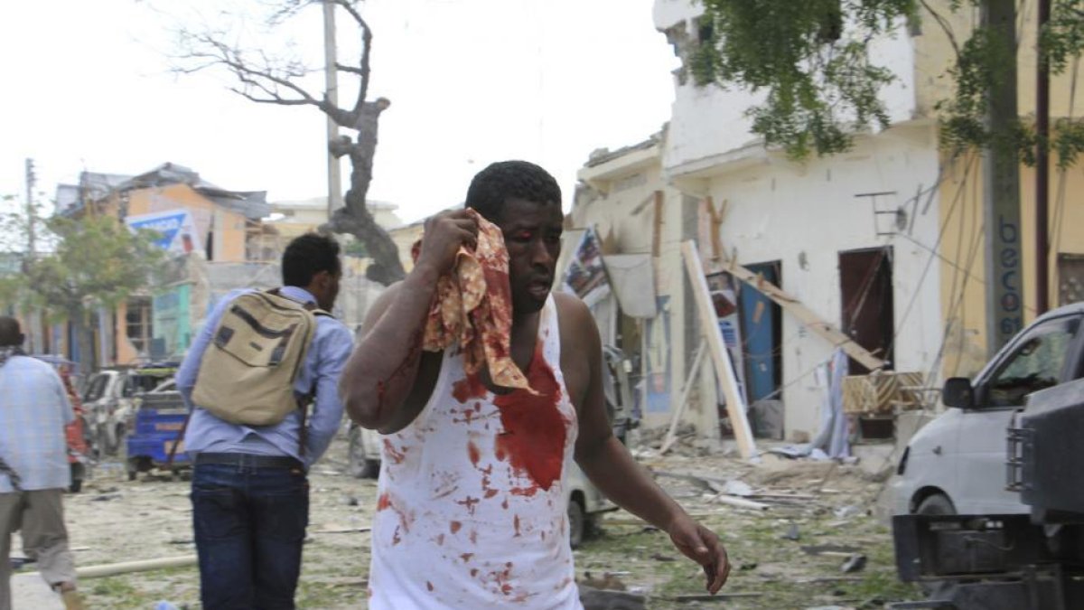 Un herido en el ataque al hotel Dayah de Mogadiscio.-FARAH ARBI WARSAMEH / AP