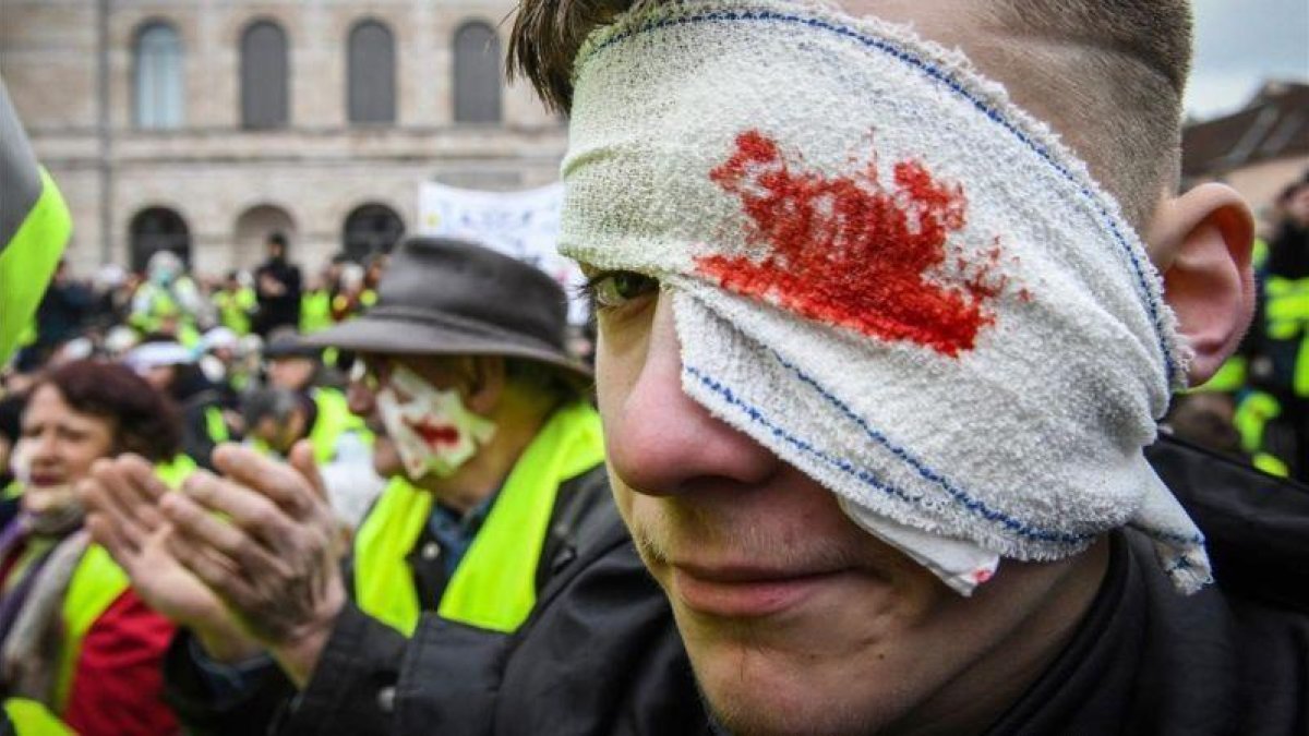 Los chalecos amarillos, con heridas falsas en los ojos, durante una manifestación.-SEBASTIEN BOZON (AFP)