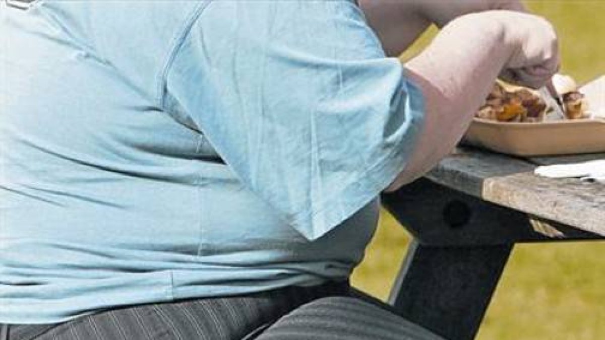 La obesidad aumenta el riesgo cardiovascular. HDS