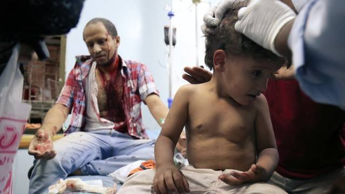 Un niño yemení recibe tratamiento tras resultar heridos en los combates.-AFP / AHMAD AL-BASHA
