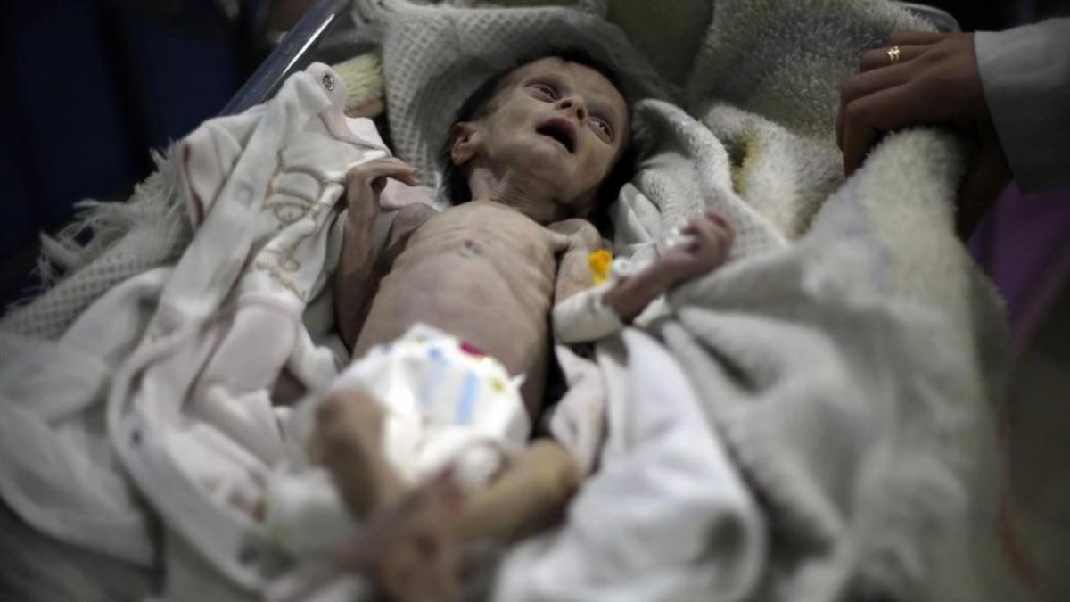 El pequeño Sahar Dofdaa poco antes de morir por desnutrición.-AFP / AMER ALMOHIBANY
