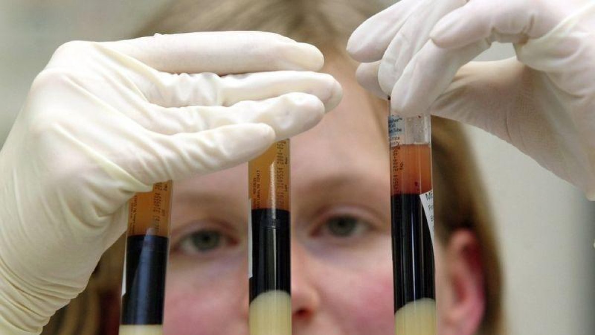 Trump asegura que Estados Unidos ha hecho avances notables en la lucha contra el VIH.-AP