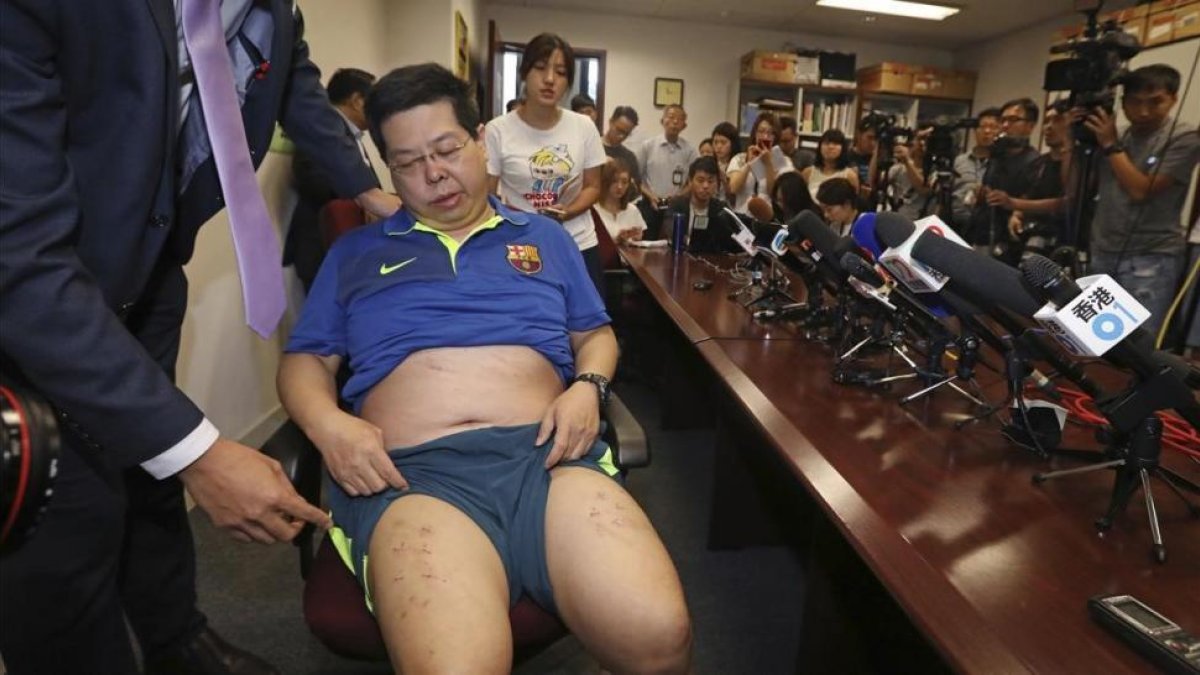 Howard Lam, con la camiseta del Barça, expone las heridas de sus piernas en una conferencia en Hong Kong el viernes 11 de agosto.-EL PERIÓDICO