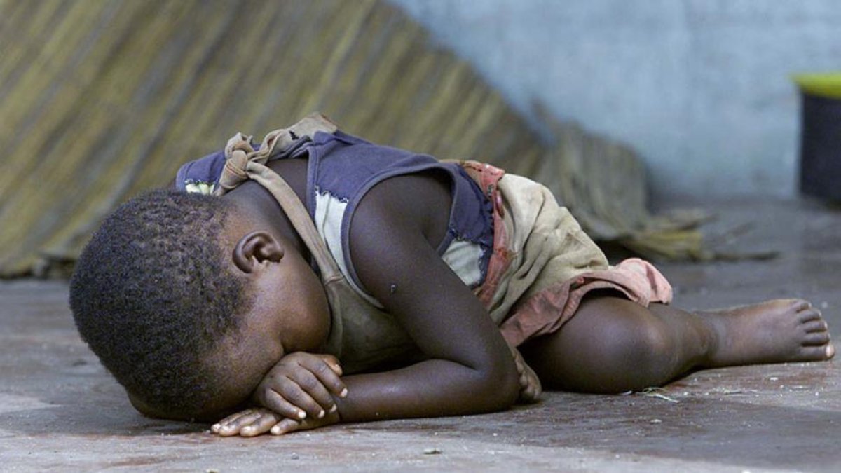 Un niño malnutrido, en un campo de refugiados de Mozambique, en una imagen de archivo.-AP / THEMBA HADEBE