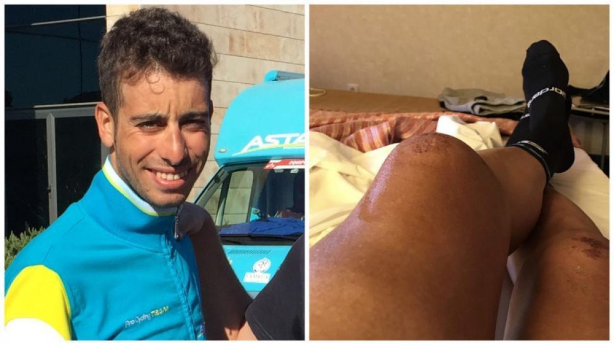 El ciclista italiano Fabio Aru y su maltrecha rodilla.-