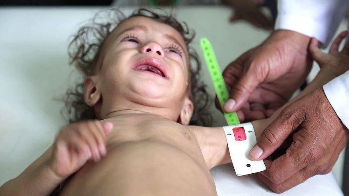 Niña yemení.-MOHAMMED AWADH (SAVE THE CHILDREN)