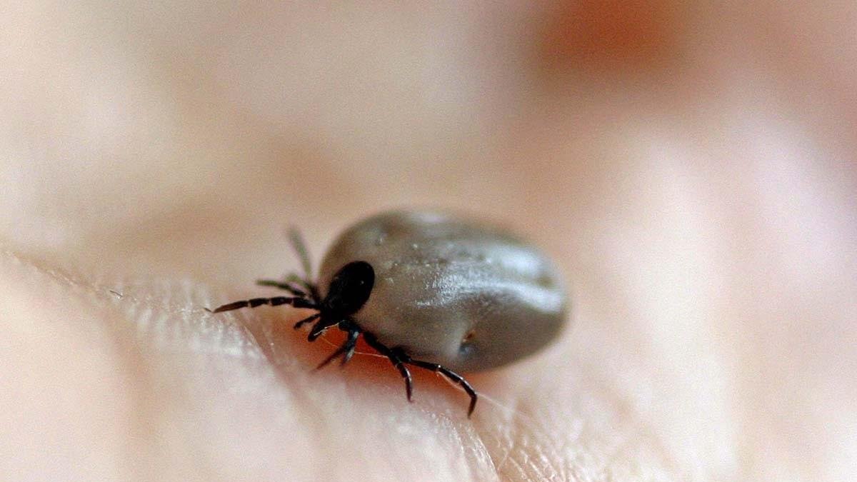 Garrapata en una mano.
